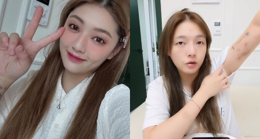 YouTuber劉力穎拒陪睡慘遭暴打！公開瘀傷、手指骨折照 怒控韓警冷處理「讓施暴者走人」